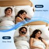 Glowvibe Chin Strap for Snoring, Adjustable Sleep Chin Support for