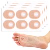 Pack of 24 Chicken Eyes Pressure Protection Rings, Chicken Eye