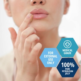 MED PRIDE Pure White Petroleum Jelly Tub 13 OZ - Effective Skin Protectant For Dry Skin, Rashes, Minor Burns & Wounds- Powerful Moisturizer For Chapped Lips, Dry Hands, Chaffed Skin & Diaper Rash