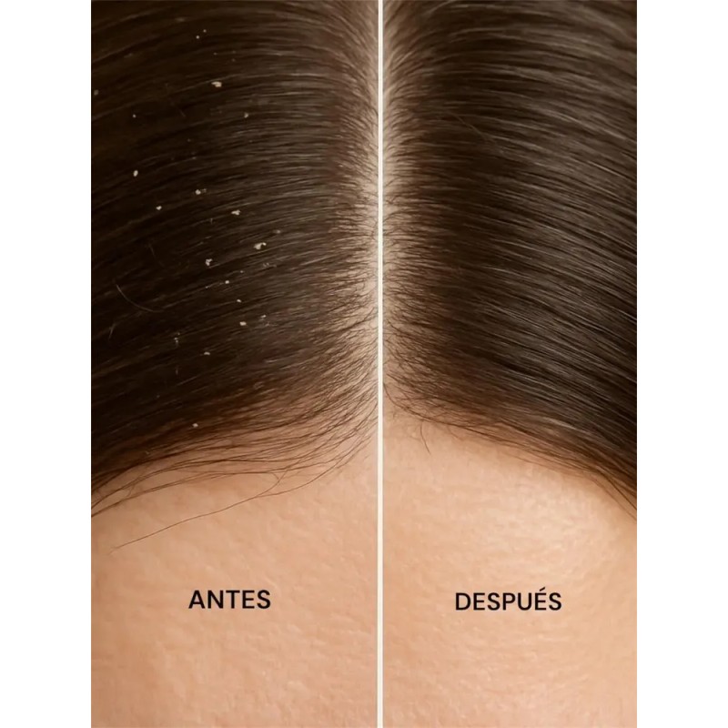 Shampoo Anticaspa Terramar Control Total De Caspa Muy Eficaz