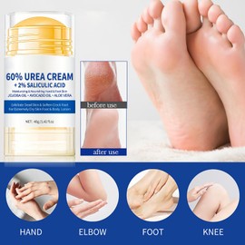 60% Urea Foot Cream for Dry Skin – Moisturizing Foot Cream, Improving Heel Repair Ointment – Fast-Acting Repair for Rough Heels, Knees, Elbows & Hands