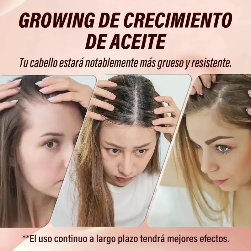 Hair Growth Oil 50ml,combate El Debilitamiento Y La Caída