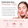 AZURE Almohadillas antienvejecimiento para debajo de los ojos con retinol
