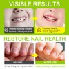 Stops Nail Chewing - Anti-Nail Biting Liquid | With Naturally