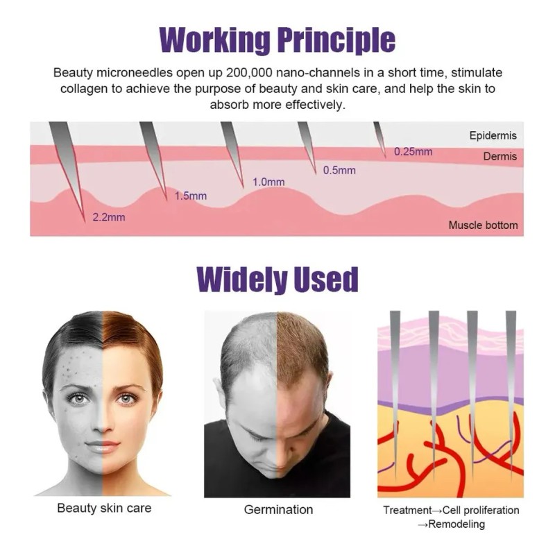 Derma Para Barba Natural 540 Roller Drs Growth Para Hombre