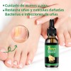 Líquido Para Hongos En Las Uñas-tratamiento Para Uñas