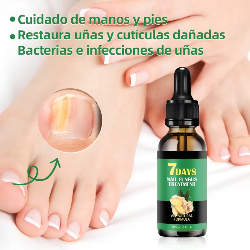 Líquido Para Hongos En Las Uñas-tratamiento Para Uñas