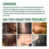 2025 . Productos Para El Cabello Loss Ouhoe Growth Prevent