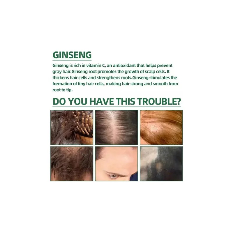2025 . Productos Para El Cabello Loss Ouhoe Growth Prevent