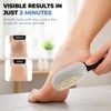 2 Pack Foot Scraper Callus Remover (Black & White), Premium
