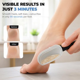 2 Pack Foot Scraper Callus Remover (Black & White), Premium Hard Skin Remover Foot File with Catcher, Dead Skin Remover for Feet, Heel Scraper for Wet & Dry Use