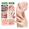 3pcs Suero Uñas Jengibre Cuidado Mopoyat