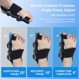 ACOAWTO Bunion Corrector for Women & Men Big Toe,Adjustable Bunion Relief Toe Straightener Bunion Splints with Soft Silicone Pad Suitable for Left/Right Feet,Black,1Pack