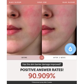 SERUMKIND Black Tulip Serum - Barrier Repair Antioxidant Korean Face Serum – Beta Glucan – Hydrating and Anti-aging – Vegan, Cruelty-Free, Unscented – 1.01 fl.oz.