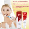 Fengyang® SP-8 Ultra Whitening Toothpaste, Probiotic Whitening Tooth-Paste, Probiotics Bright