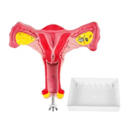 Rensimote 1:1 Human Female Uterus Ovary Fallopian Tubes Model Anatomical Human Anatomy Model Teaching Tools