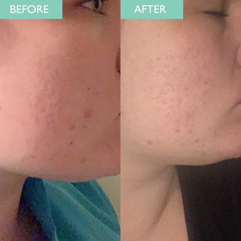 SKINICIAN Purifying mask