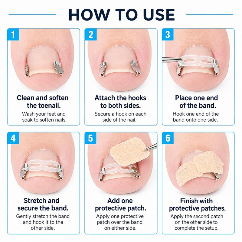 Toenail Correction Set, Straight & Curved Nail Clips for Ingrown