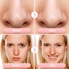 Blackhead Remover Pore Vacuum Upgraded Facial Pore Cleaner Electric Comedone