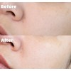 Skin Moisturizing Soothing Cream Skin Retential Fade Free EGF Post-Plot
