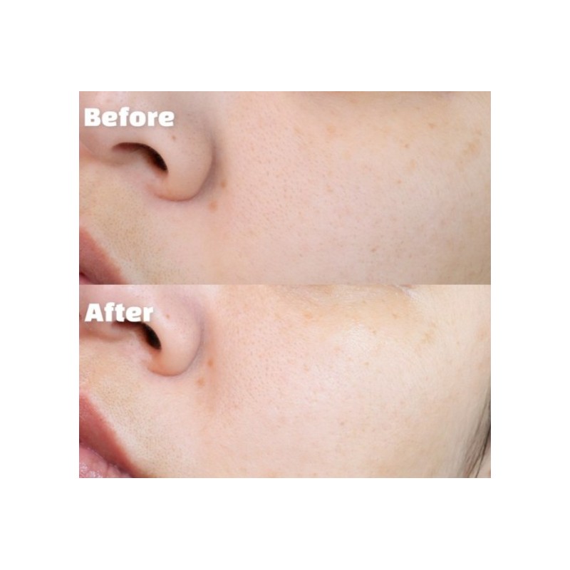 Skin Moisturizing Soothing Cream Skin Retential Fade Free EGF Post-Plot