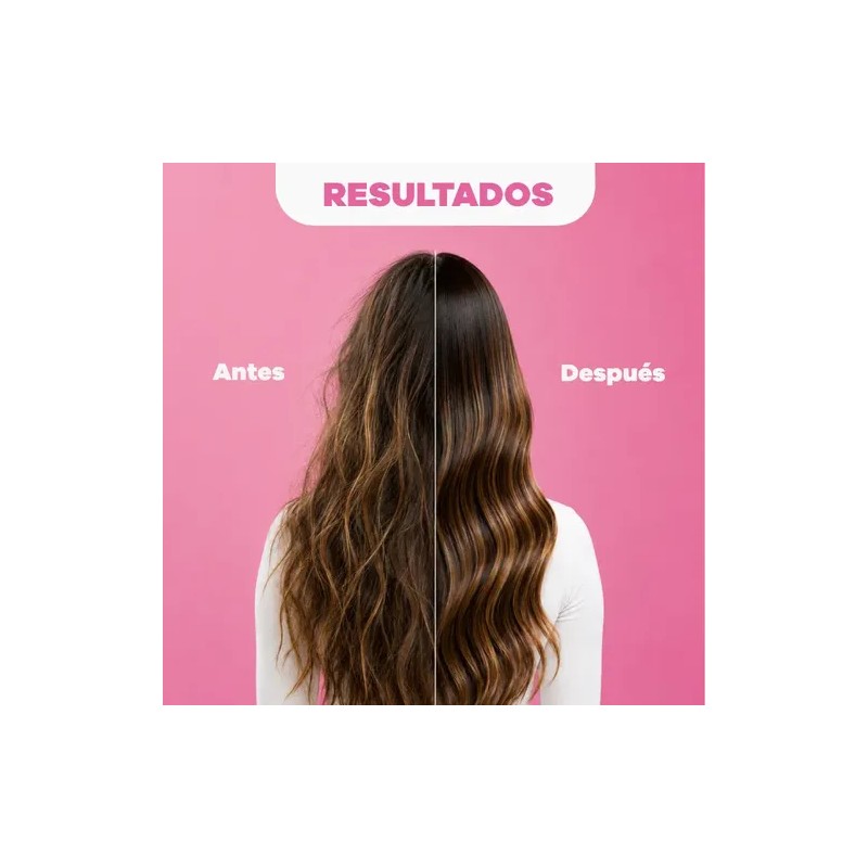 Shampoo Y Tratamiento Natural Sant Cebolla Romero Biotina
