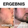 Vinsk Beard Roller, Beard Roller for a Strong & Full