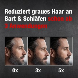 Alpecin Grey Attack Beard & Temples Color Booster 50 ml – Covering Grey Hair on Beard and Temples – For Naturally Dark Men's Hair – Gradual Repigmentation, with 5,6-DHI Technology