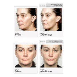 Tonificador facial microcorrientes + gel conductor 3×20 ml blanco, reafirma y tonifica rostro