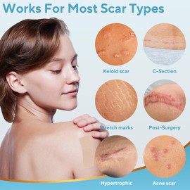 Silicone Scar Sheets, Silicone Scar Tape, Reusable Scar Silicone Strips for Scar Removal Treatment, Soft Silicone Scar Sheets for Surgical Scars, Keloid, C-Section, Burn et(1.6” x 59” Roll-1.5M)