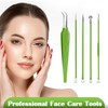 FVION 5 Pieces Blackhead Remover, Comedone Squeezer Set, Pimple Squeezing