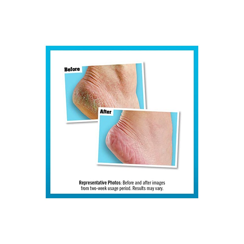 O'Keeffe's Healthy Feet Exfoliating 8144200, Peppermint, 85 gram