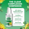 Tónico aclarante + sérum con eucalipto Witch Hazel de Dickinson