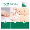 Crema Removedora Mezquinos Verrugas Lunares Eficaz Sin Dolor