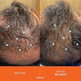 Shampoo DS Laboratories Revita para Crecimiento del Cabello DS Laboratories Revita High-Performance Hair Density Shampoo Shampoo                      