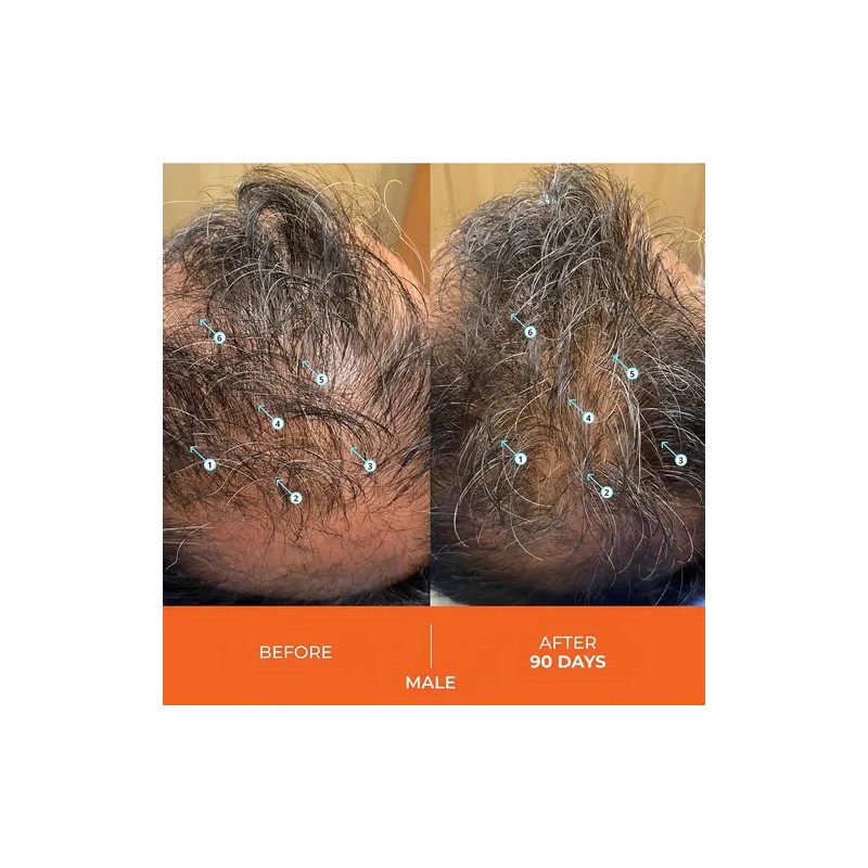Shampoo DS Laboratories Revita para Crecimiento del Cabello DS Laboratories