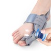 Generisch Hallux Valgus Correction Fixation Plate Upgrade Hallux Valgus Bunion