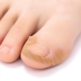 4 soft fingernail toenail stickers toe protection patch tape One set 6ea