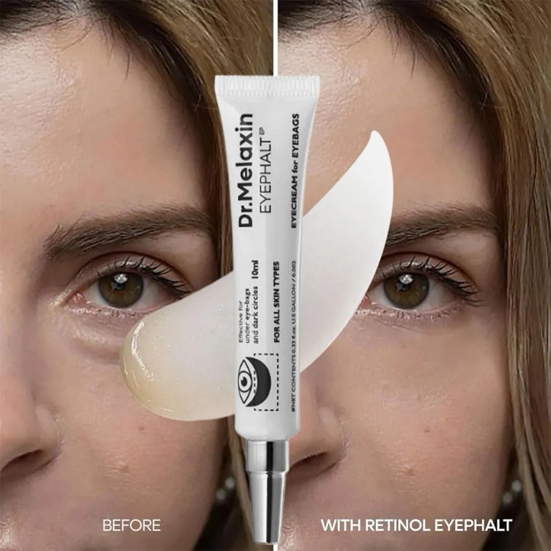 La Crema Reparadora Para Ojos Tensa Y Reduce Las Líneas
