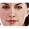 Serum Aclarante Facial Nicotinamida Arbutina Manchas Ojera30