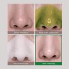 Some By Mi 30 Days Miracle Acné 4 Productos