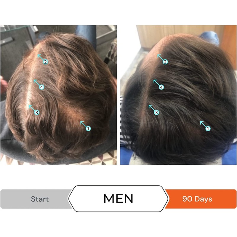 Revita Hair Loss Conditioner 205ml