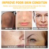 Turmeric Serum, Turmeric Serum for Correcting Dark Spots, Repair Serum
