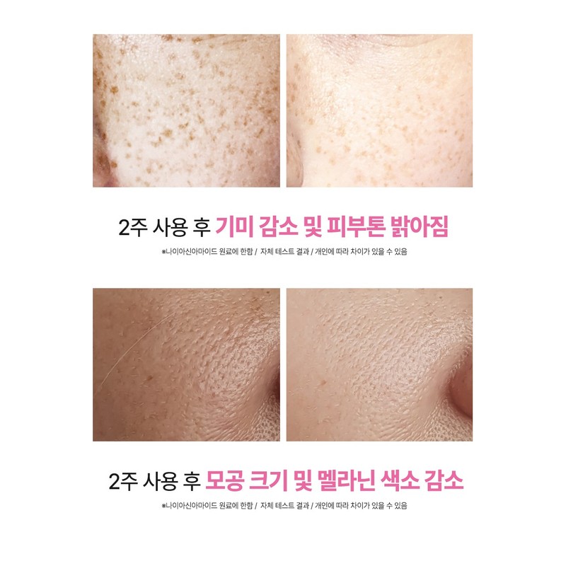 (기미/화이트닝) 빅토나인 리포좀 글루타치온 레티놀 크림 백옥크림 기미 잡티 검버섯
