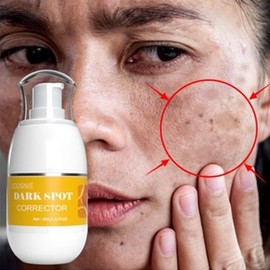 Pigmentation face whitening freckle regeneration cream 40g / 색소 침착 얼굴 미백 기미 재생 크림 40g