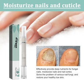 Nail Care Pen, Nagelöl Stift, Nagelpflege stift mit Vitaminen, Cuticle Oil Nagelhautöl für Nägel, Ernährung Öl Stift für Fuß und Finger von Rissigen ＆ Trockenen Nägeln