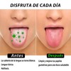 Juego de 4 Limpiadores de Lengua de Acero Inoxidable