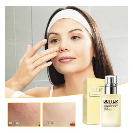 Crema Facial, Loción Hidratante Refrescante Y Cuidado, 100 G