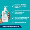 CeraVe Gel Limpiador Control Imperfecciones Para Piel con Tendencia al