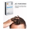 Pack 2 Nourkrin Man Tratamiento Anticaída Hombre 60tabs
